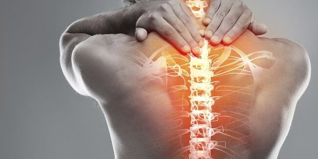 Opciones médicas para la terapia de osteocondrosis cervical