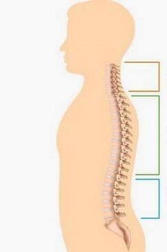 Osteocondrosis de partes partes diferentes de la columna vertebral
