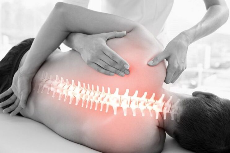 Sesiones de terapia manual para la osteocondrosis de la columna torácica.